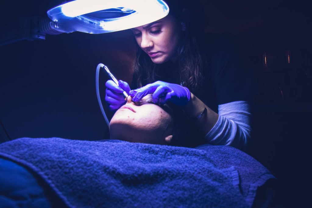 Facial Microdermabrasion